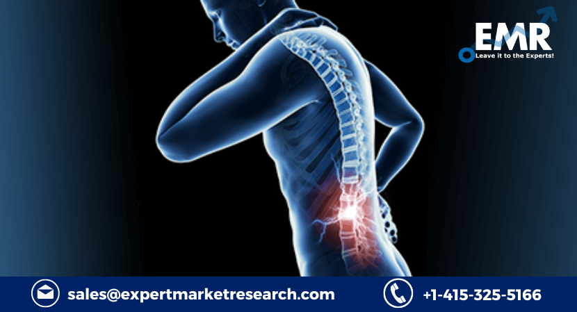Spinal Cord Stimulation Market Trends